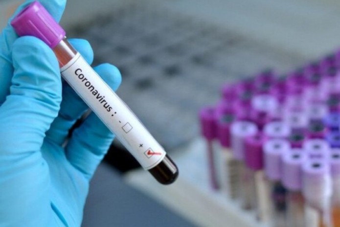 Число случаев заражения коронавирусом достигло 3444