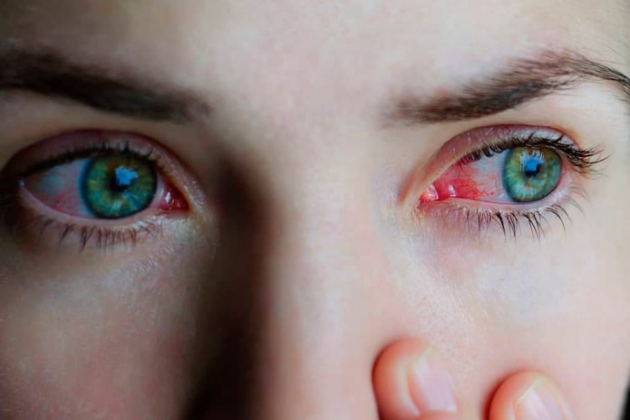 «Омикрон» может проникнуть в организм человека через глаза - эксперт