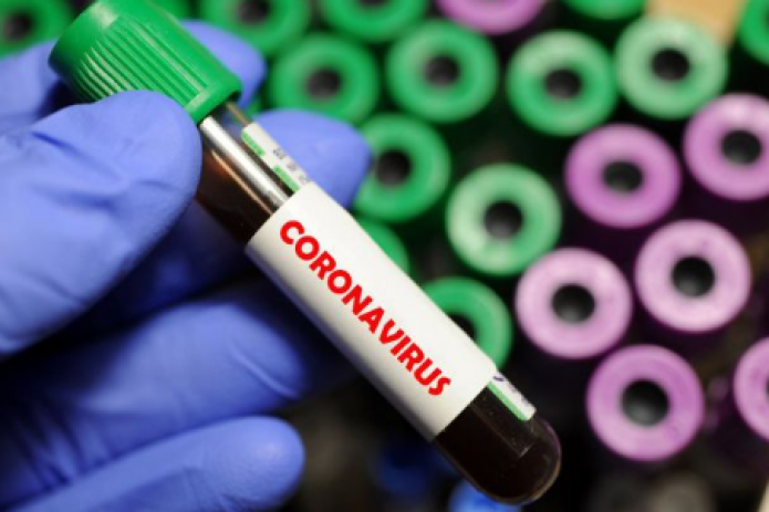 9 июля количество человек заболевших коронавирусом увеличилось на рекордные 472